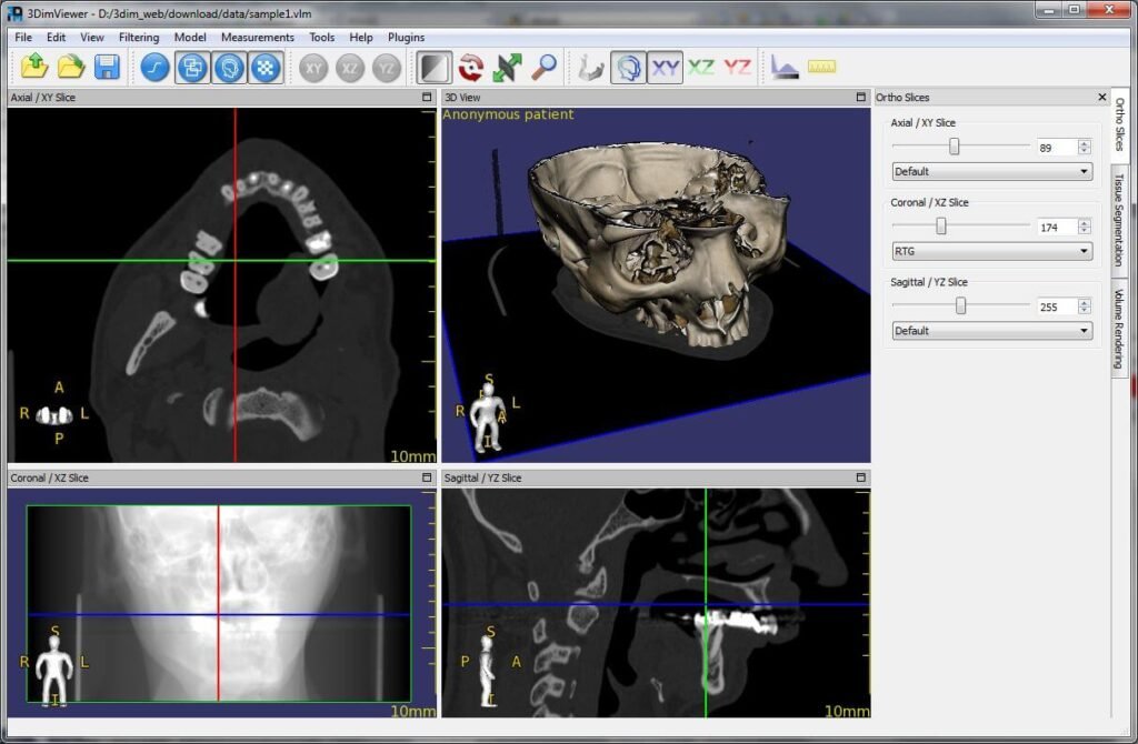 DICOM software free